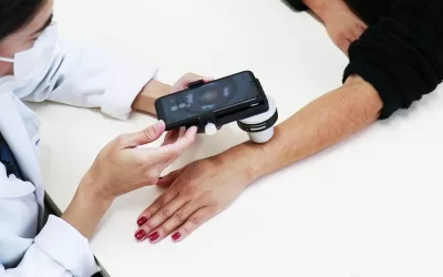 Projeto do HA facilitará diagnóstico precoce do câncer de pele com cabine de autoatendimento