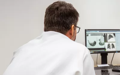 Câncer de pulmão: HA une tecnologia, ciência e prevenção para mudar cenário da doença no Brasil